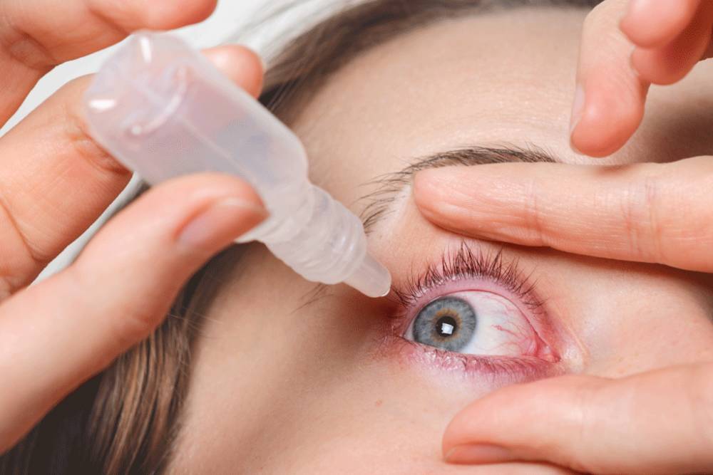 The Simple Ways To Treat Conjunctivitis At Home Naturally