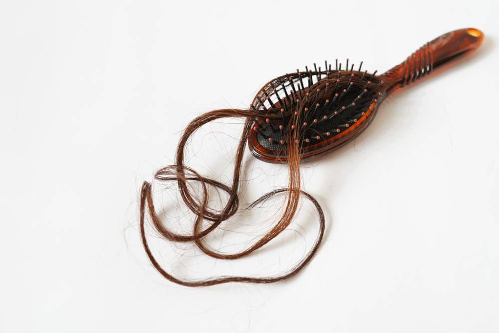 Home Remedies for Hair Loss