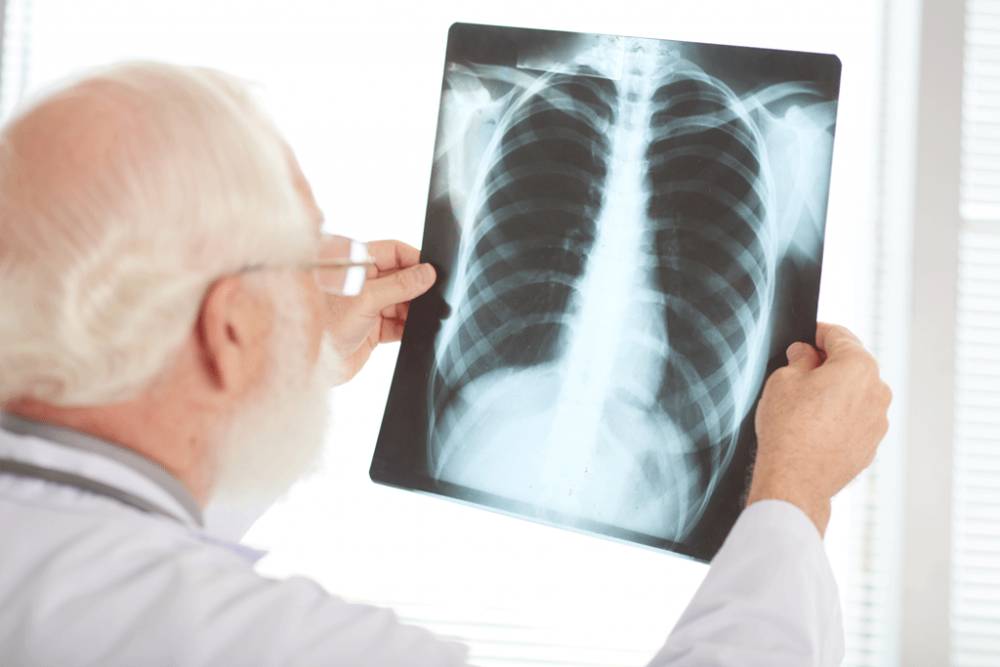 Home Remedies for Pneumonia